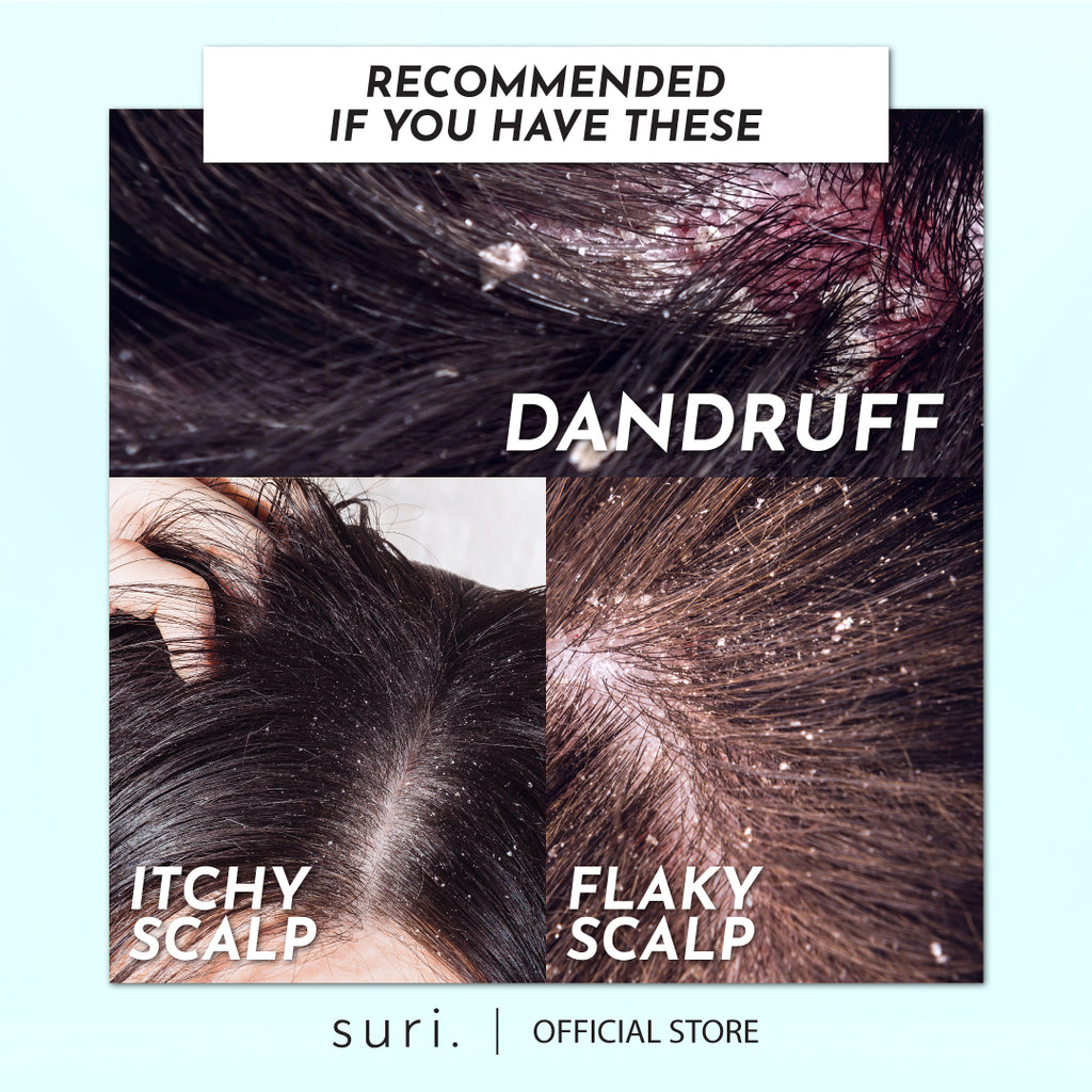 Suri Relieve : Dandruff & Itchy Control Treatment Shampoo