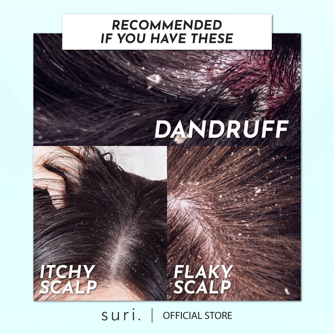 Suri Relieve : Dandruff & Itchy Control Treatment Shampoo